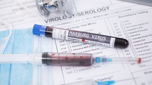 Etiópia potvrdzuje prvé smrteľné ohnisko vírusu Marburg