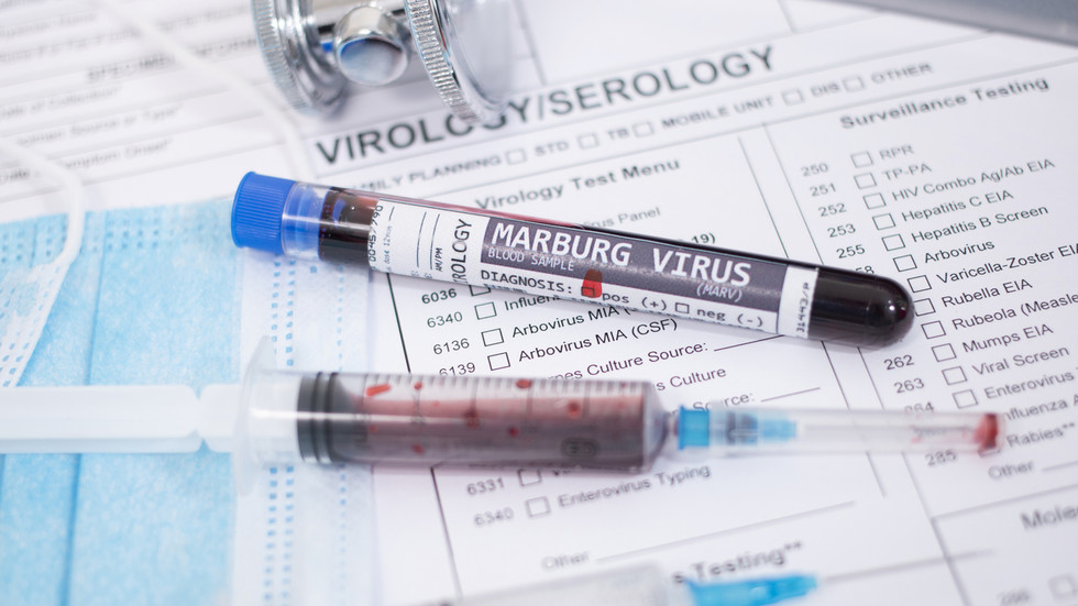 Etiópia potvrdzuje prvé smrteľné ohnisko vírusu Marburg