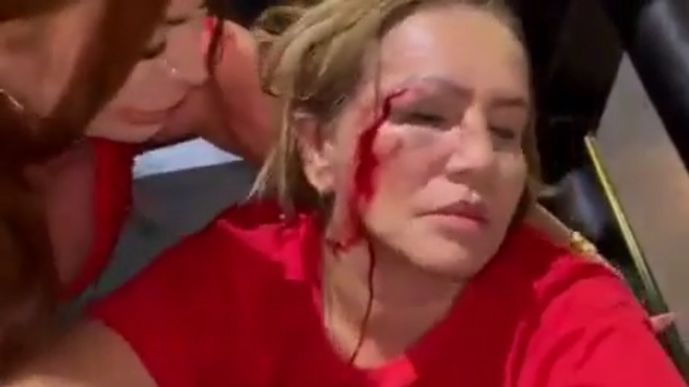 Lulova spojenka napadnutá pred kľúčovými voľbami v Brazílii (VIDEO) Lulova spojenka napadnutá pred kľúčovými voľbami v Brazílii (VIDEO)